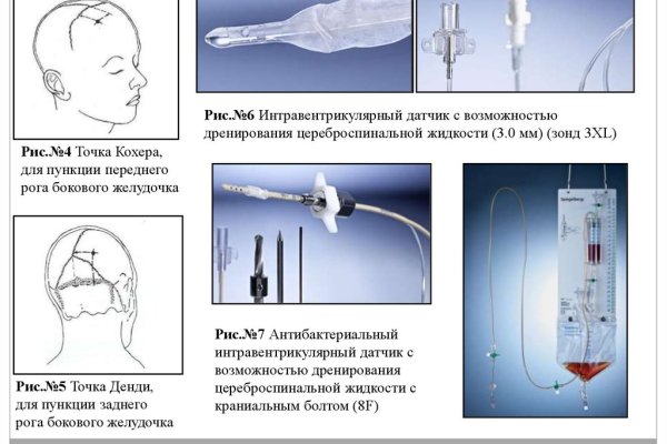 Кракен ссылка fo feng crmp ru